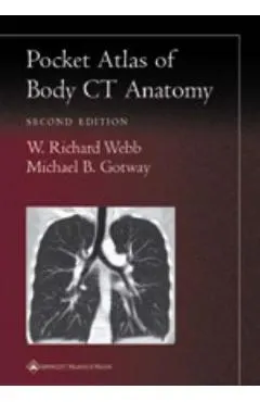 Pocket Atlas of Body CT Anatomy