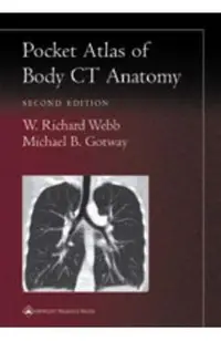 Pocket Atlas of Body CT Anatomy