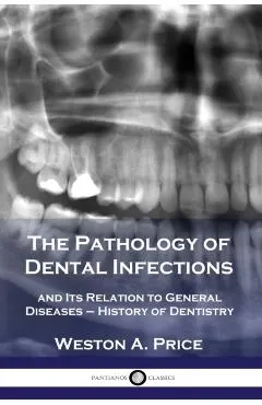 The Pathology of Dental Infections: and Its Relation to General Diseases - History of Dentistry