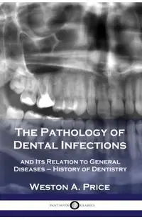 The Pathology of Dental Infections: and Its Relation to General Diseases - History of Dentistry