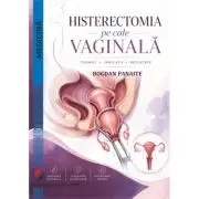 Histerectomia pe cale vaginala