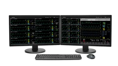 Cms Vet Mindray - Sistem Central de Monitorizare
