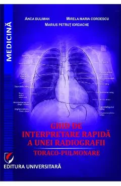 Ghid de interpretare rapida a unei radiografii toraco-pulmonare - Anca Buliman, Mirela Maria Coroescu, Marius Petrut Iordache