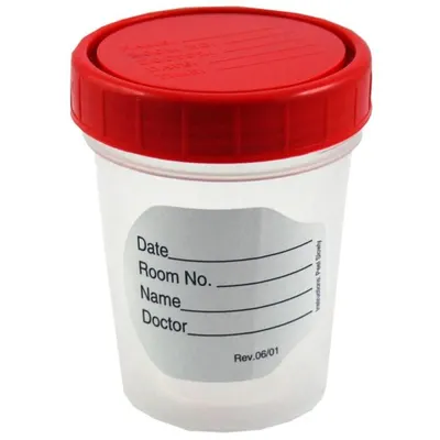 Set 14 x Recipient Urocultor Steril, Prima, 120 ml