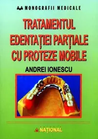 Tratamentul edentației parțiale cu proteze mobile - Paperback brosat - Andrei Ionescu