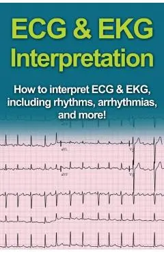 ECG & EKG Interpretation: How to interpret ECG & EKG, including rhythms, arrhythmias, and more!