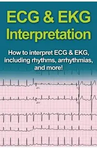 ECG & EKG Interpretation: How to interpret ECG & EKG, including rhythms, arrhythmias, and more!