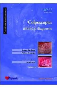 Colposcopia: tehnica si diagnostic