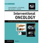 Interventional Oncology: Principles and Practice of Image-Guided Cancer Therapy