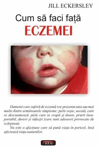 Cum să faci faţă eczemei - Paperback brosat - Jill Eckersley