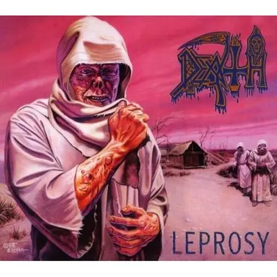 Leprosy