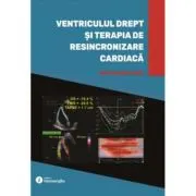 Ventriculul drept si terapia de resincronizare cardiaca