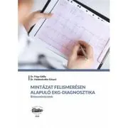 Diagnostic ECG bazat pe recunoasterea de tipare. Tipare de ritm. In limba maghiara