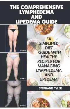 The Comprehensive Lymphedema and Lipedema Guide: The Comprehensive Lymphedema and Lipedema Guide