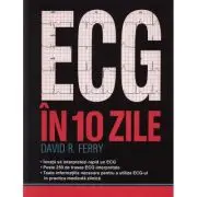 ECG-UL in 10 zile
