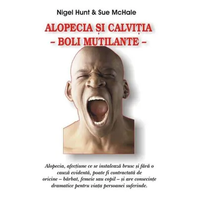 Alopecia şi calviţia - Paperback brosat - Nigel Hunt, Sue McHale