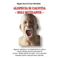 Alopecia şi calviţia - Paperback brosat - Nigel Hunt, Sue McHale