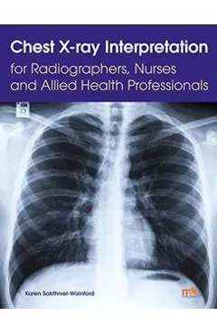 Chest X-ray Interpretation for Radiographers, Nurses and All