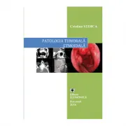 Patologia tumorala etmoidala. Strategii actuale in diagnostic si tratament