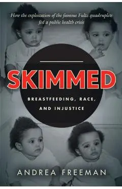 Skimmed: Breastfeeding, Race, and Injustice
