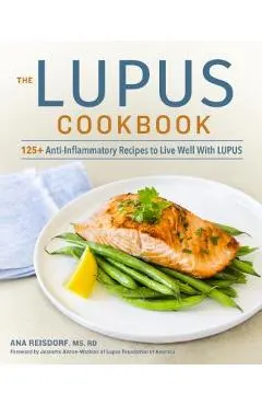 The Lupus Cookbook: 125+ Anti-Inflammatory Recipes to Live Well with Lupus