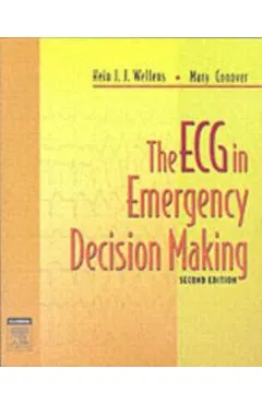 ECG in Emergency Decision Making