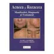 Acneea si rozaceea