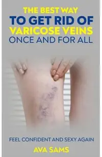 The Best Way to Get Rid of Varicose Veins Once and For All: Feel Confident and Sexy Again: Feel confident and sexy again