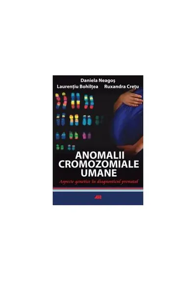 Anomalii cromozomiale umane. Aspecte genetice în diagnosticul prenatal - Paperback brosat - Daniela Neagoş, Laurenţiu Bohîlţea, Ruxandra Creţu