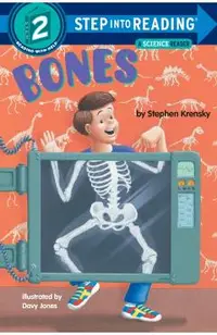 Bones