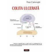 Colita ulcerata