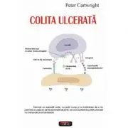 Colita ulcerata