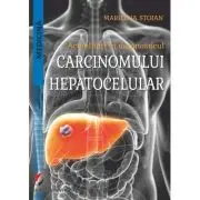 Actualitati in diagnosticul carcinomului hepatocelular