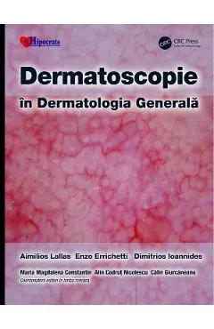 Dermatoscopie in Dermatologia Generala