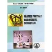 Protezele partiale mobilizabile scheletate