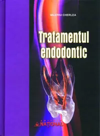 Tratamentul endodontic - Hardcover - Valeriu Cherlea