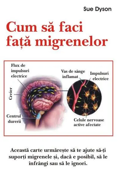 Cum să faci faţă migrenelor - Paperback brosat - Sue Dyson