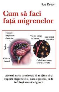Cum să faci faţă migrenelor - Paperback brosat - Sue Dyson