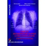 Ghid de interpretare rapida a unei radiografii toraco-pulmonare