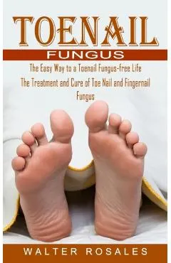 Toenail Fungus: The Easy Way to a Toenail Fungus-free Life (The Treatment and Cure of Toe Nail and Fingernail Fungus)