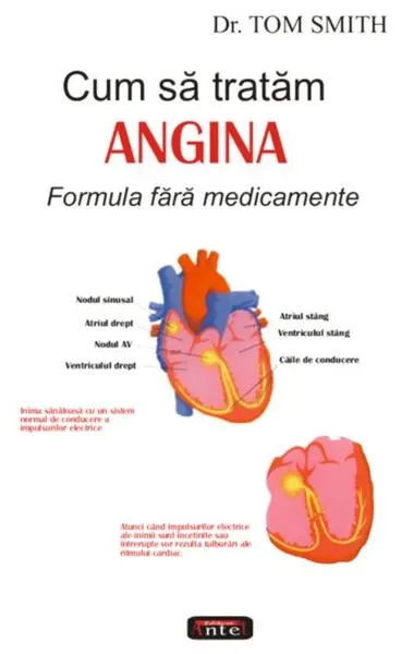 Cum să tratăm angina - Paperback brosat - Tom Rob Smith