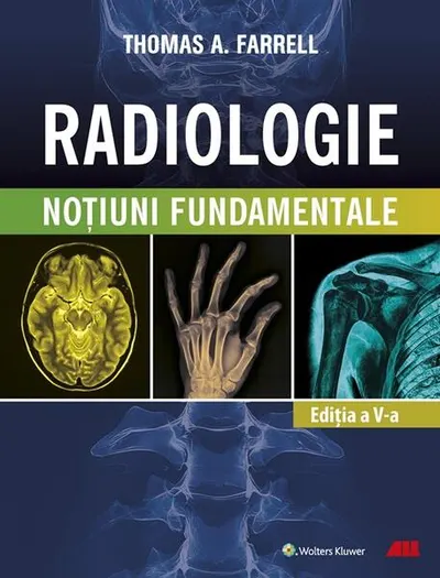Radiologie - Paperback brosat - Thomas A. Farrell