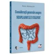 Consideratii generale asupra neoplasmului colonic