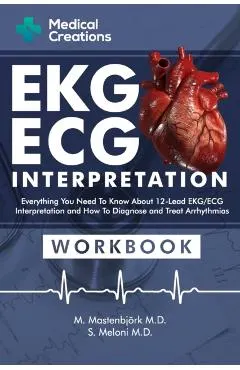EKG/ECG Interpretation: Everything you Need to Know about the 12 - Lead ECG/EKG Interpretation and How to Diagnose and Treat Arrhythmias: Work