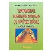 Tratamentul edentatiei partiale cu proteze mobile