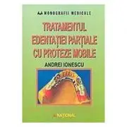 Tratamentul edentatiei partiale cu proteze mobile