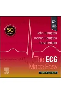 ECG Made Easy