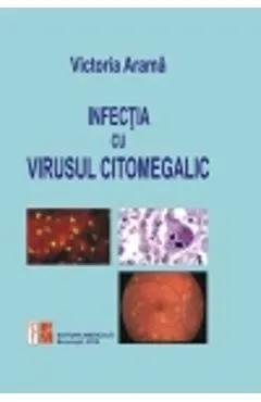 Infectia cu virusul citomegalic