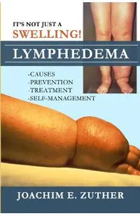 It's Not Just a Swelling! Lymphedema: Causes, Prevention, Treatment, Self-Management