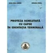 Proteza scheletata cu capse in edentatia terminala